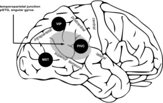 前庭感覚に関わる大脳皮質の位置を示した図